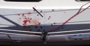 Wash off blood and red wine quickly